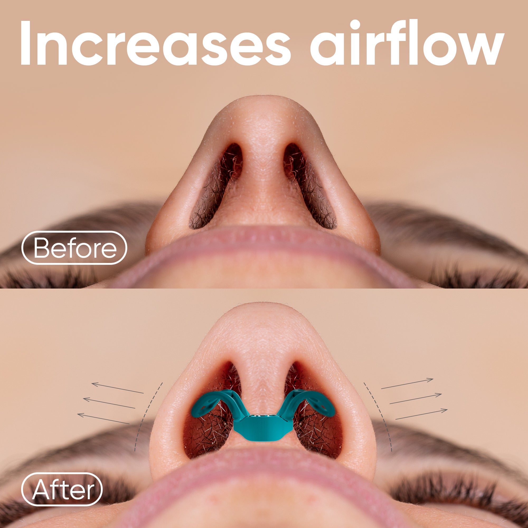 Nasal Dilators for Breathing