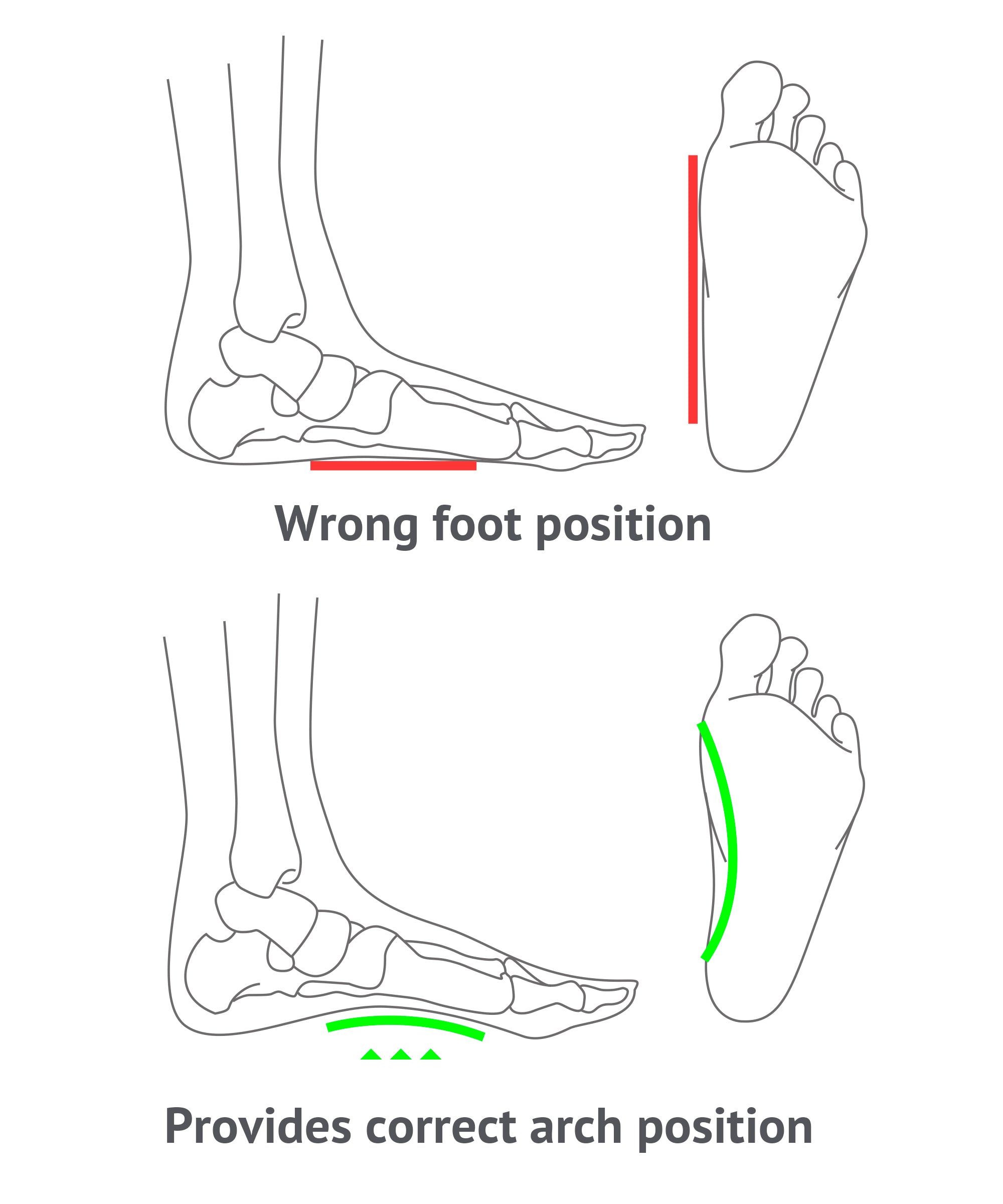 Orthotics Arch Support