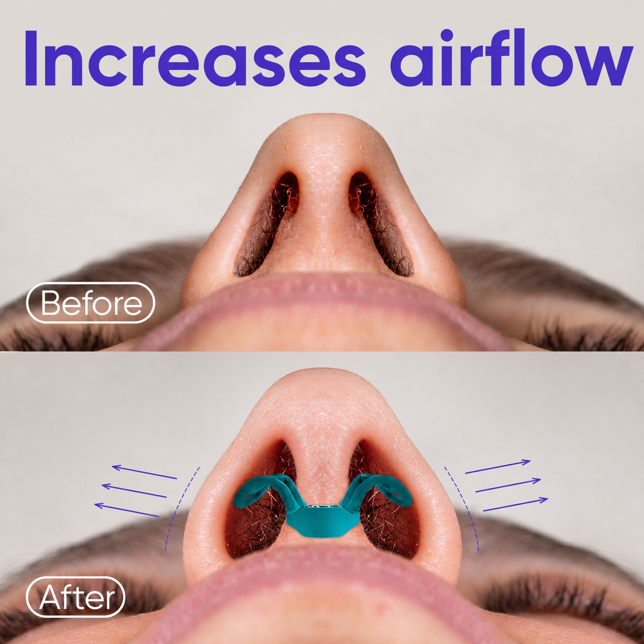 Nasal Dilators for Breathing