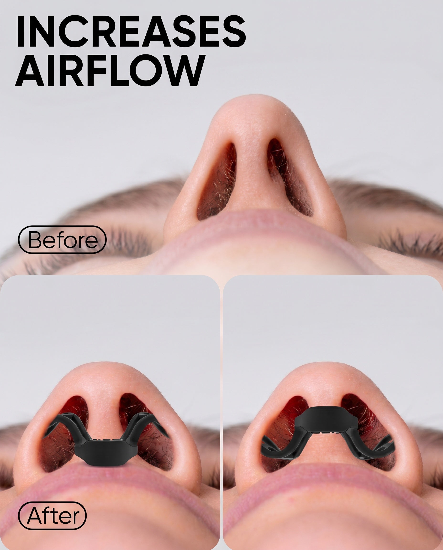Brison nasal dilators, nose dilators, breathing dilator, nose openers for sleeping