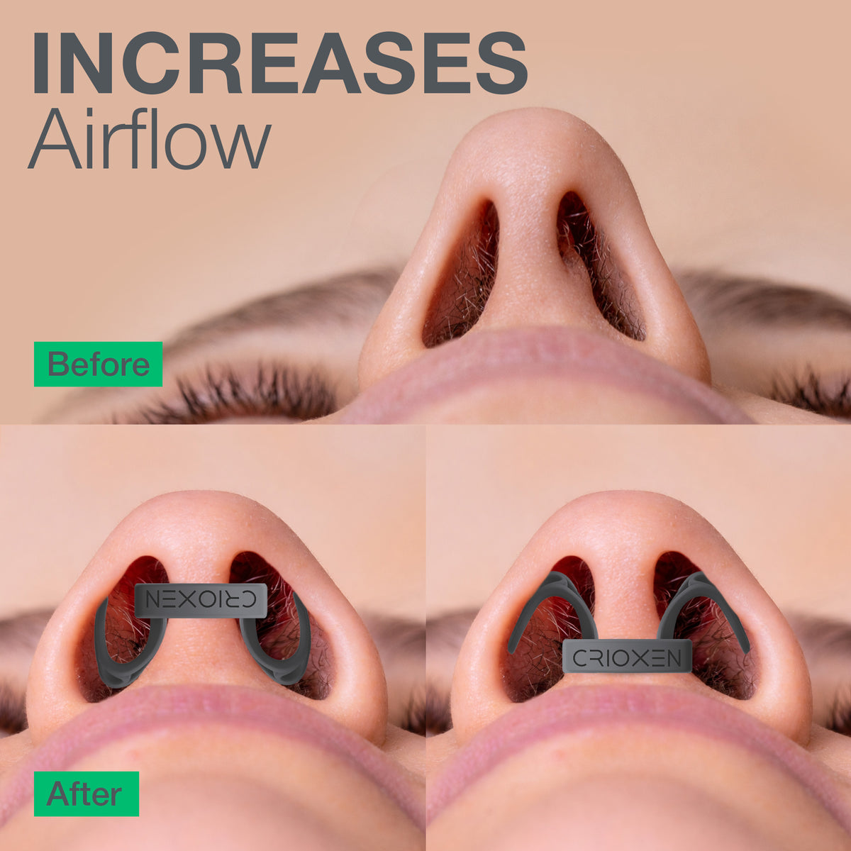 CRIOXEN Nasal Dilator for Easier Nasal Breathing and Better Sleep. Reusable Anti-Snoring Device. Helps Improve Airflow, Open Nasal Passages, Reduce Snoring and Support Sports Performance. Before and After installing Nasal Dilators.
